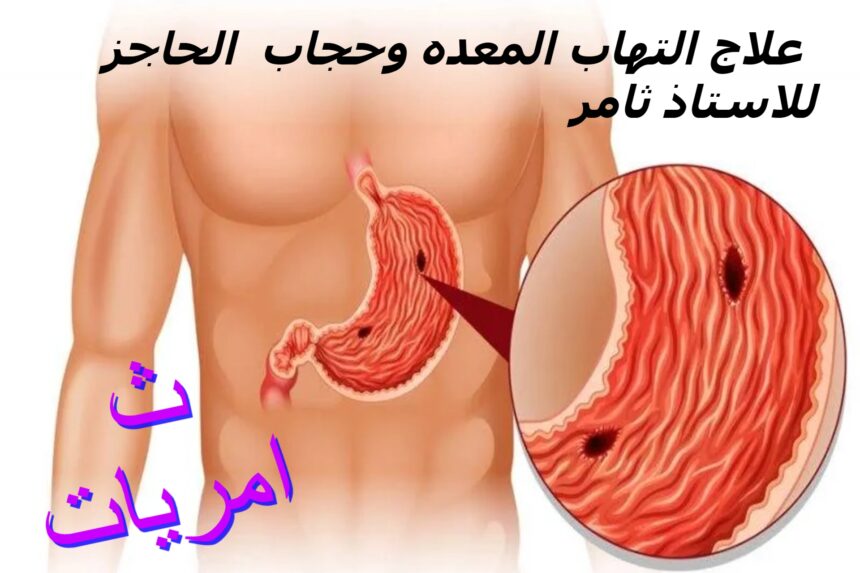 علاج التهاب المعده وحجاب الحاجز للاستاذ ثامر.ثامريات