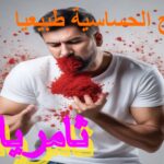 علاج الحساسية طبيعيا ثامريات